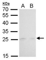 MAD2 Antibody in Western Blot (WB)