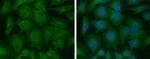 ME1 Antibody in Immunocytochemistry (ICC/IF)