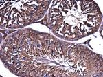 ME1 Antibody in Immunohistochemistry (Paraffin) (IHC (P))