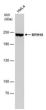 MYH10 Antibody in Western Blot (WB)