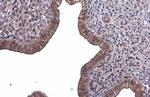 PLS3 Antibody in Immunohistochemistry (Paraffin) (IHC (P))