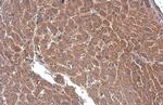 PLS3 Antibody in Immunohistochemistry (Paraffin) (IHC (P))