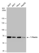 PLS3 Antibody in Western Blot (WB)