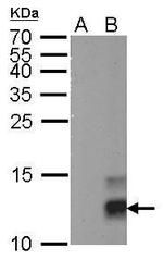 PPY Antibody in Western Blot (WB)