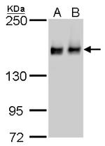 ROCK1 Antibody in Western Blot (WB)