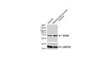 SDHA Antibody in Western Blot (WB)