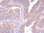 SUPV3L1 Antibody in Immunohistochemistry (Paraffin) (IHC (P))