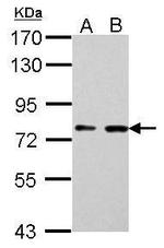 SUPV3L1 Antibody in Western Blot (WB)