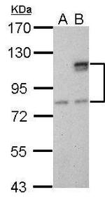 SUPV3L1 Antibody in Western Blot (WB)