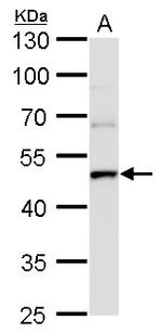 UQCRC1 Antibody in Western Blot (WB)