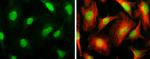 ARID1A Antibody in Immunocytochemistry (ICC/IF)