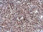 ARID1A Antibody in Immunohistochemistry (Paraffin) (IHC (P))