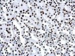 H4K16ac Antibody in Immunohistochemistry (Paraffin) (IHC (P))