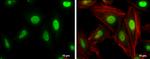 Cullin 4A Antibody in Immunocytochemistry (ICC/IF)