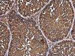 eIF3h Antibody in Immunohistochemistry (Paraffin) (IHC (P))