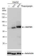 SQSTM1 Antibody in Western Blot (WB)