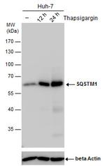 SQSTM1 Antibody in Western Blot (WB)
