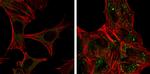 ATG12 Antibody in Immunocytochemistry (ICC/IF)