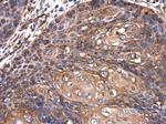 ROCK2 Antibody in Immunohistochemistry (Paraffin) (IHC (P))