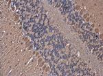 YAP1 Antibody in Immunohistochemistry (Paraffin) (IHC (P))