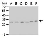 ETHE1 Antibody in Western Blot (WB)