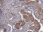 PSAT1 Antibody in Immunohistochemistry (Paraffin) (IHC (P))