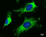 FIS1 Antibody in Immunocytochemistry (ICC/IF)