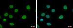 ELP3 Antibody in Immunocytochemistry (ICC/IF)