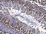 ENY2 Antibody in Immunohistochemistry (Paraffin) (IHC (P))