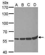 PRDM14 Antibody in Western Blot (WB)