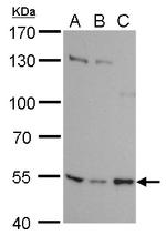 SETD6 Antibody in Western Blot (WB)