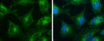 SNX27 Antibody in Immunocytochemistry (ICC/IF)