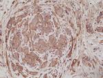 Alpha Actinin 4 Antibody in Immunohistochemistry (Paraffin) (IHC (P))