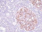 Aurora B Antibody in Immunohistochemistry (Paraffin) (IHC (P))