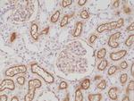 CD10 Antibody in Immunohistochemistry (Paraffin) (IHC (P))