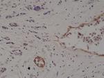 CD10 Antibody in Immunohistochemistry (Paraffin) (IHC (P))