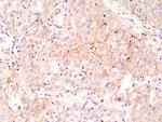 PD-L1 (CD274) Antibody in Immunohistochemistry (Paraffin) (IHC (P))