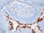 PD-L1 (CD274) Antibody in Immunohistochemistry (Paraffin) (IHC (P))