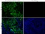 B7-H3 (CD276) Antibody in Immunohistochemistry (Paraffin) (IHC (P))