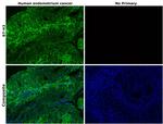 B7-H3 (CD276) Antibody in Immunohistochemistry (Paraffin) (IHC (P))