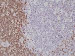 CD5 Antibody in Immunohistochemistry (Paraffin) (IHC (P))