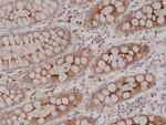 CD66e (CEA) Antibody in Immunohistochemistry (Paraffin) (IHC (P))