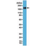 CD66e (CEA) Antibody in Western Blot (WB)