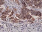 p16INK4a Antibody in Immunohistochemistry (Paraffin) (IHC (P))