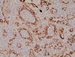 Cytokeratin 17 Antibody in Immunohistochemistry (Paraffin) (IHC (P))