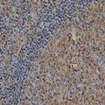 Ubiquitin Antibody in Immunohistochemistry (Paraffin) (IHC (P))