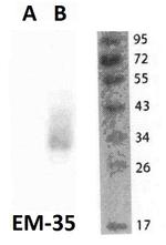 FOLR2 Antibody in Western Blot (WB)