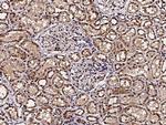 ACOX1 Antibody in Immunohistochemistry (Paraffin) (IHC (P))