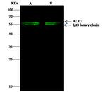 ACVRL1 Antibody in Immunoprecipitation (IP)