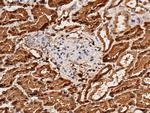 Aminoacylase Antibody in Immunohistochemistry (Paraffin) (IHC (P))